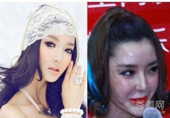 關(guān)于明星整容失敗死亡的探討，明星整容失敗引發(fā)悲劇，深度探討背后的故事